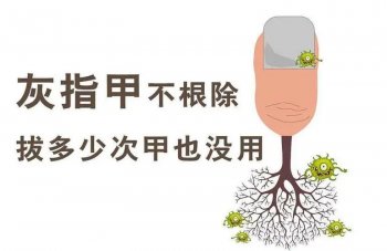 南京皮肤病研究所治疗灰指甲怎么样?