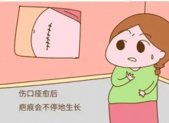 很多年的疤痕真的可以修复吗