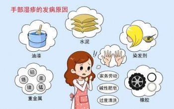 湿疹怎么治疗能好