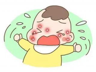 反复过敏是免疫力低吗