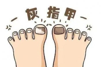 南京皮肤研究所灰指甲挂什么号