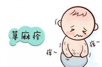 丘疹性荨麻疹怎么治疗