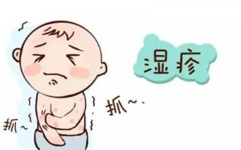 得了湿疹怎么办怎样才能好得快